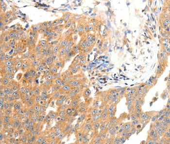 DOPEY1 Antibody in Immunohistochemistry (Paraffin) (IHC (P))