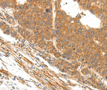 DOPEY1 Antibody in Immunohistochemistry (Paraffin) (IHC (P))