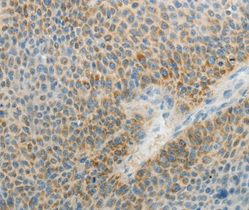 AGAP1 Antibody in Immunohistochemistry (Paraffin) (IHC (P))