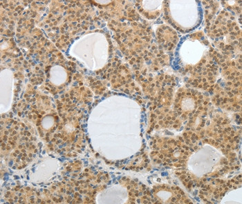 AKAP6 Antibody in Immunohistochemistry (Paraffin) (IHC (P))