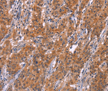 ARPC4 Antibody in Immunohistochemistry (Paraffin) (IHC (P))