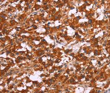 ARPC4 Antibody in Immunohistochemistry (Paraffin) (IHC (P))