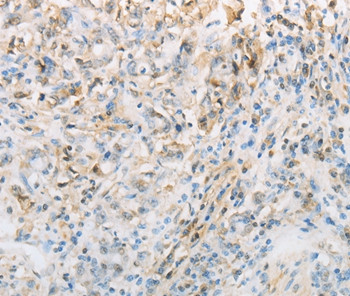 CNP Antibody in Immunohistochemistry (Paraffin) (IHC (P))