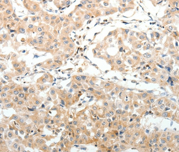 SV2A Antibody in Immunohistochemistry (Paraffin) (IHC (P))