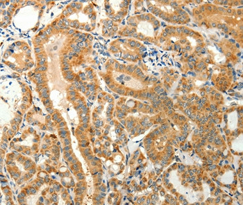 TMSB4X Antibody in Immunohistochemistry (Paraffin) (IHC (P))