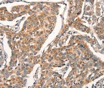 ARFRP1 Antibody in Immunohistochemistry (Paraffin) (IHC (P))