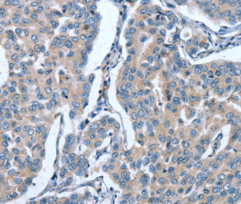 GINS1 Antibody in Immunohistochemistry (Paraffin) (IHC (P))