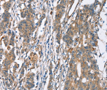 SLC4A1 Antibody in Immunohistochemistry (Paraffin) (IHC (P))