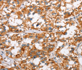 SLC4A1 Antibody in Immunohistochemistry (Paraffin) (IHC (P))