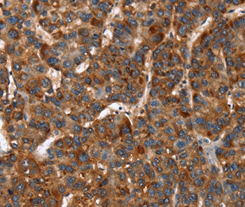 CACNB2 Antibody in Immunohistochemistry (Paraffin) (IHC (P))