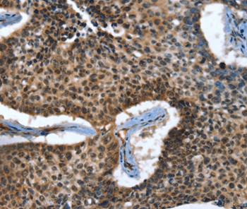 CACNB2 Antibody in Immunohistochemistry (Paraffin) (IHC (P))