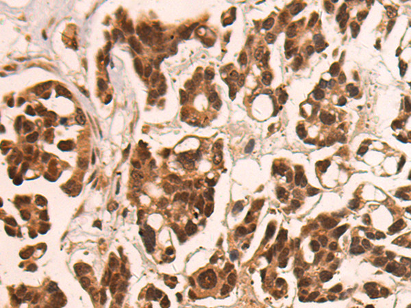 CAMTA1 Antibody in Immunohistochemistry (Paraffin) (IHC (P))