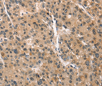 CRIM1 Antibody in Immunohistochemistry (Paraffin) (IHC (P))