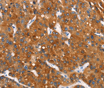 MT-CYB Antibody in Immunohistochemistry (Paraffin) (IHC (P))