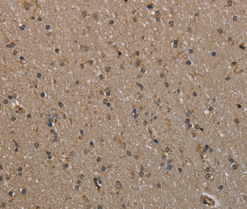 MYO18B Antibody in Immunohistochemistry (Paraffin) (IHC (P))