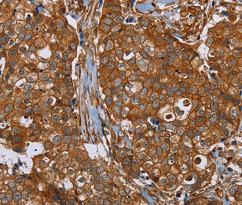 Plectin Antibody in Immunohistochemistry (Paraffin) (IHC (P))