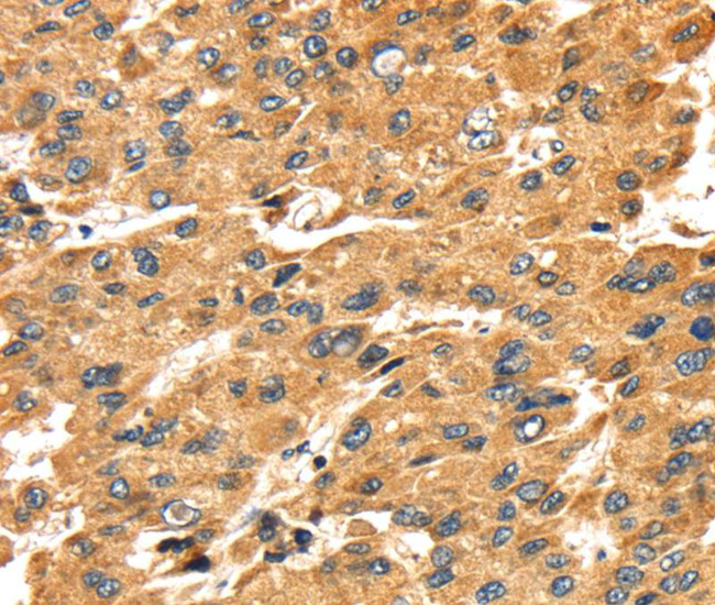 SH3KBP1 Antibody in Immunohistochemistry (Paraffin) (IHC (P))