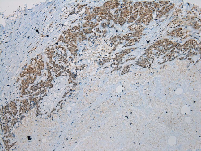 UTS2B Antibody in Immunohistochemistry (Paraffin) (IHC (P))