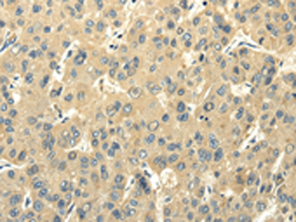 FABP8 Antibody in Immunohistochemistry (Paraffin) (IHC (P))