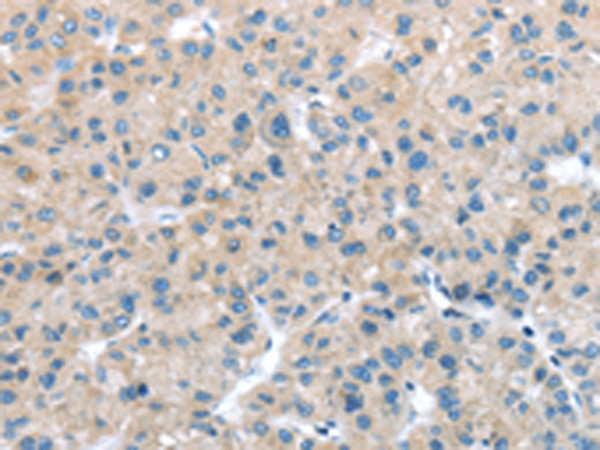 ITPA Antibody in Immunohistochemistry (Paraffin) (IHC (P))