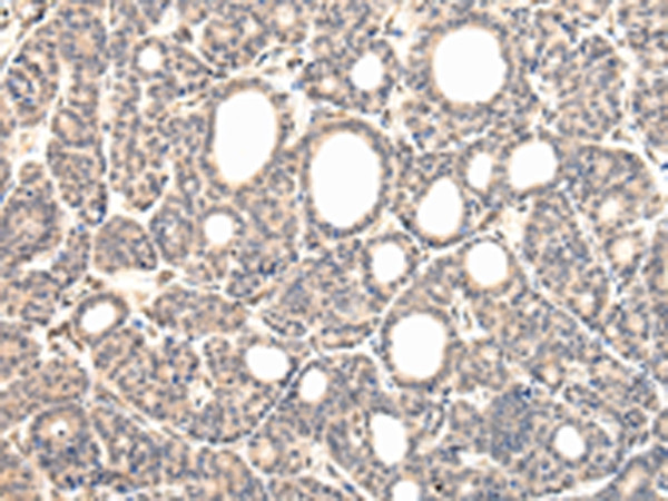 VPS37D Antibody in Immunohistochemistry (Paraffin) (IHC (P))