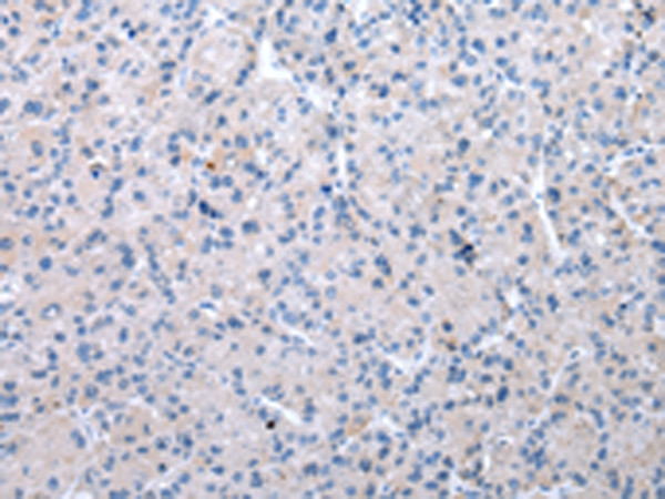 XKR6 Antibody in Immunohistochemistry (Paraffin) (IHC (P))
