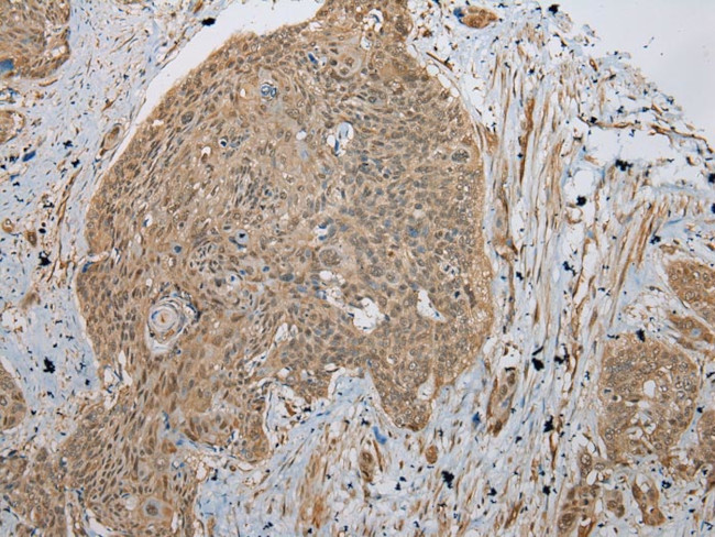 TBCA Antibody in Immunohistochemistry (Paraffin) (IHC (P))