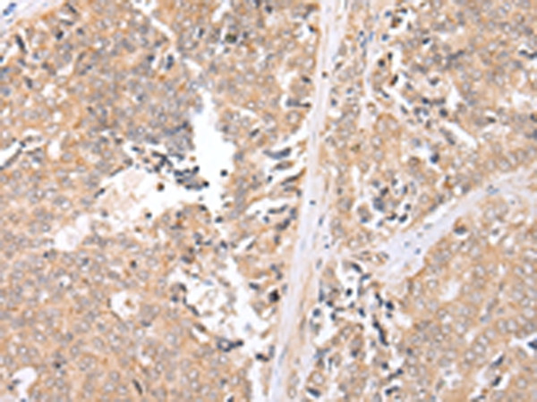 MMGT1 Antibody in Immunohistochemistry (Paraffin) (IHC (P))