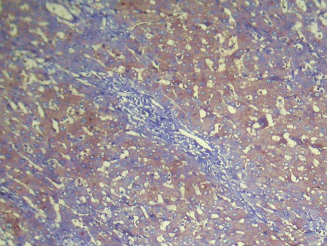 NUDT2 Antibody in Immunohistochemistry (Paraffin) (IHC (P))