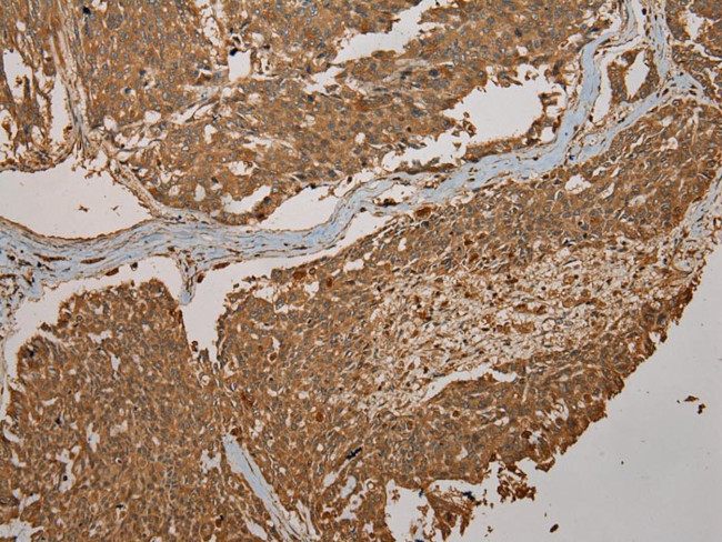 CYP20A1 Antibody in Immunohistochemistry (Paraffin) (IHC (P))