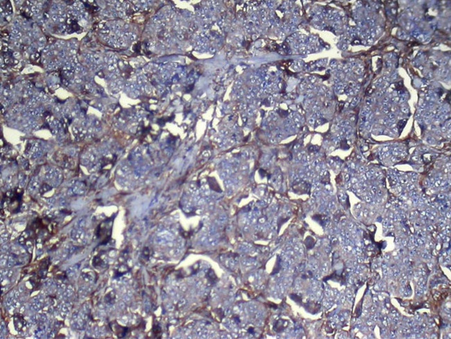 NNMT Antibody in Immunohistochemistry (Paraffin) (IHC (P))