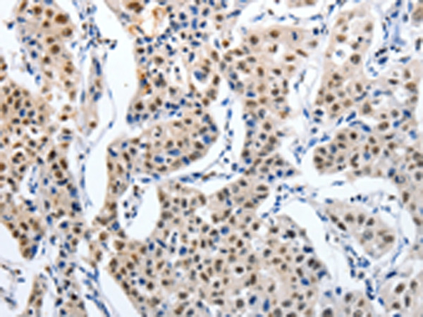 MAGEA6 Antibody in Immunohistochemistry (Paraffin) (IHC (P))