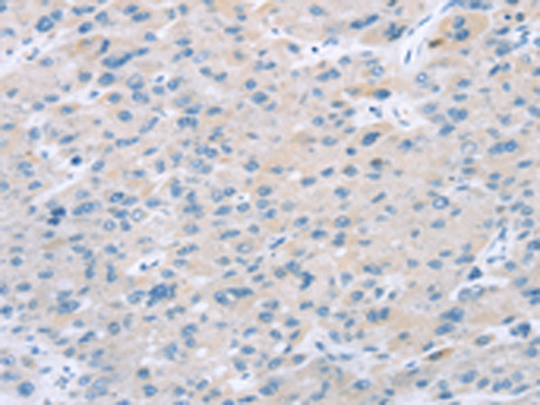 EI24 Antibody in Immunohistochemistry (Paraffin) (IHC (P))