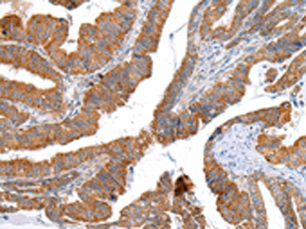 XKR4 Antibody in Immunohistochemistry (Paraffin) (IHC (P))