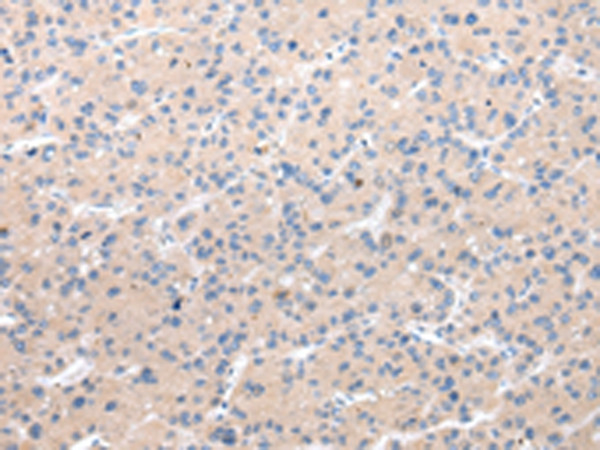 CHRM5 Antibody in Immunohistochemistry (Paraffin) (IHC (P))