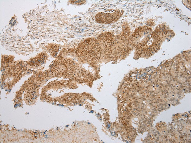 PPIL1 Antibody in Immunohistochemistry (Paraffin) (IHC (P))