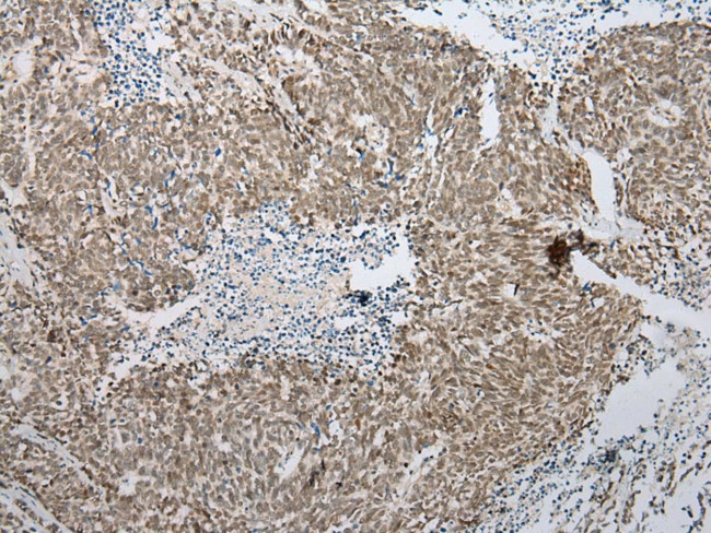 PPIL1 Antibody in Immunohistochemistry (Paraffin) (IHC (P))