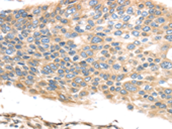 TMED2 Antibody in Immunohistochemistry (Paraffin) (IHC (P))