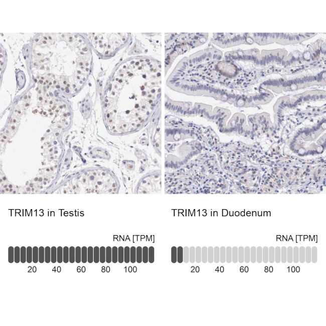 RFP2 Antibody in Immunohistochemistry (IHC)