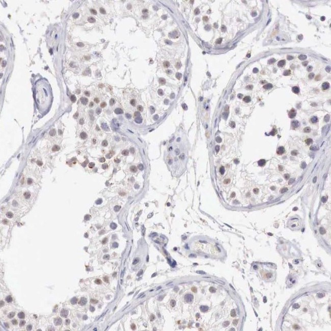 RFP2 Antibody in Immunohistochemistry (IHC)