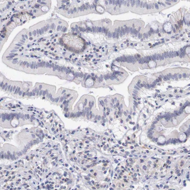 RFP2 Antibody in Immunohistochemistry (IHC)