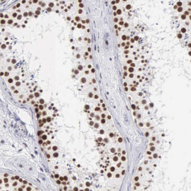 CSTF2 Antibody in Immunohistochemistry (IHC)