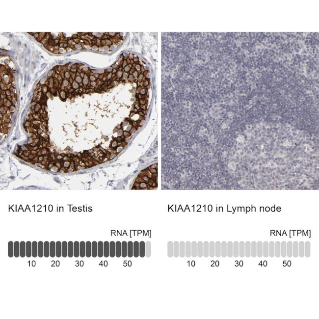 KIAA1210 Antibody in Immunohistochemistry (IHC)