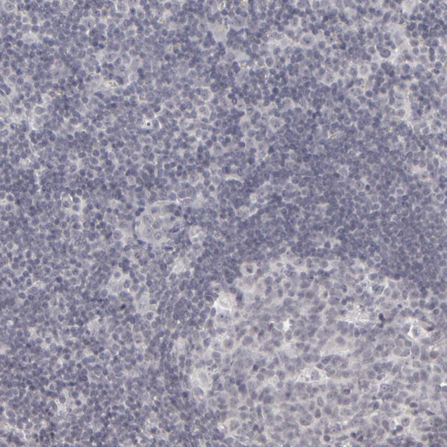 KIAA1210 Antibody in Immunohistochemistry (IHC)