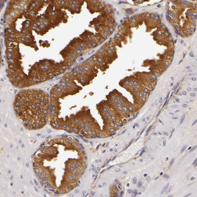 LGALS3BP Antibody in Immunohistochemistry (IHC)