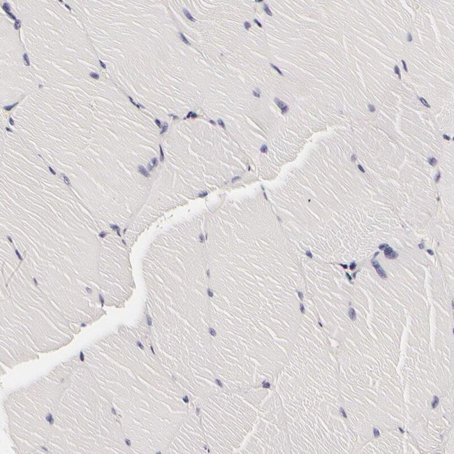 LGALS3BP Antibody in Immunohistochemistry (IHC)