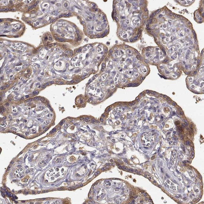 CRIM1 Antibody in Immunohistochemistry (IHC)