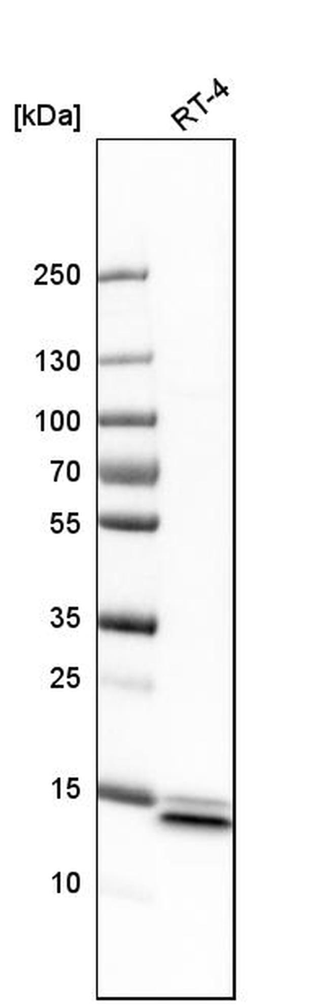 SYNJ2BP Antibody in Western Blot (WB)