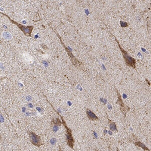 NPTXR Antibody in Immunohistochemistry (IHC)