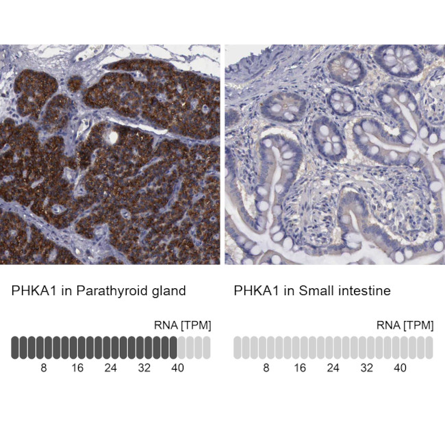 PHKA1 Antibody in Immunohistochemistry (IHC)